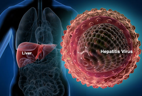 hepatits a outbreak